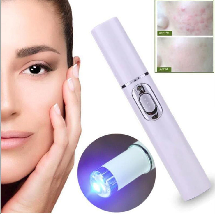 Dispozitiv Laser Anti-Acne cu Terapie cu Lumină Albastră