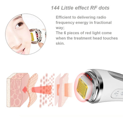 Dispozitiv Facial de Riduri cu Radiofrecvență și Întinerire