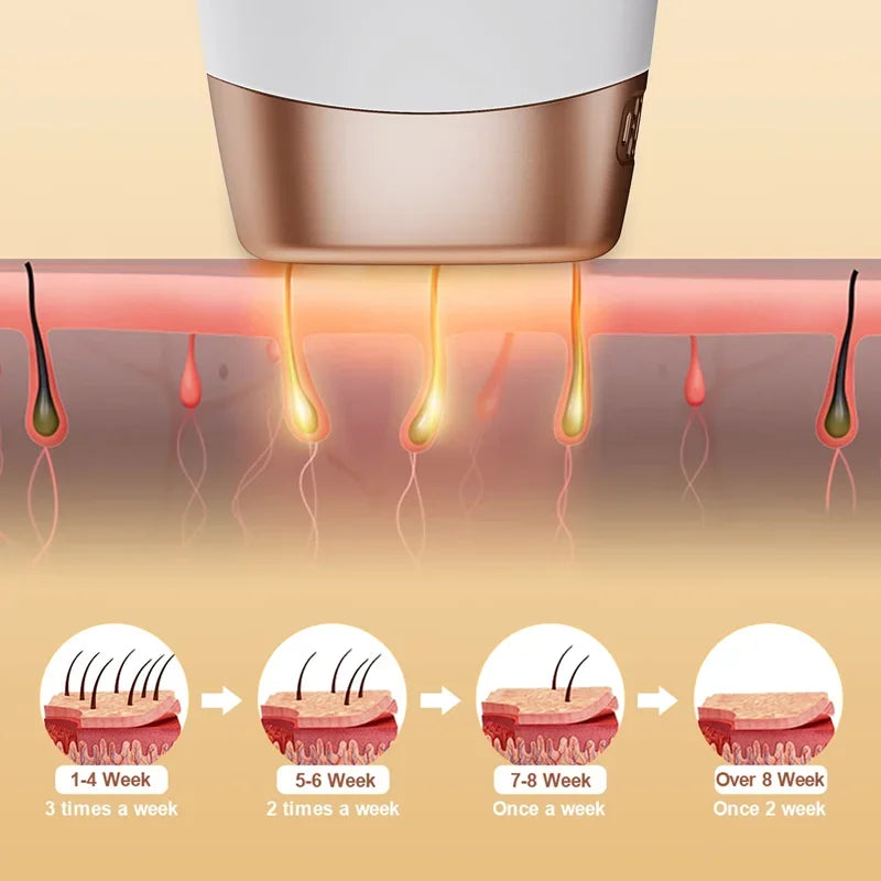 Epilator Laser IPL 999,999 Flashes pentru Îndepărtarea Părului