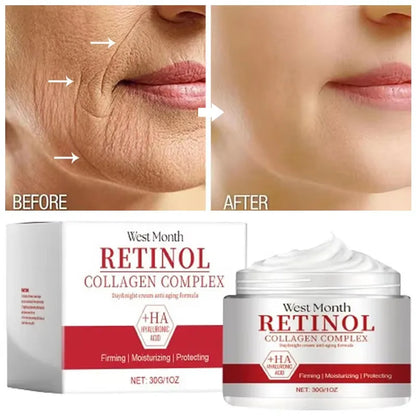 Crema de Față cu Retinol 30g - Îndepărtare Riduri și Ființe Fine