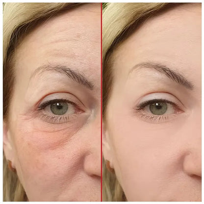 Crema de Față cu Retinol 30g - Îndepărtare Riduri și Ființe Fine