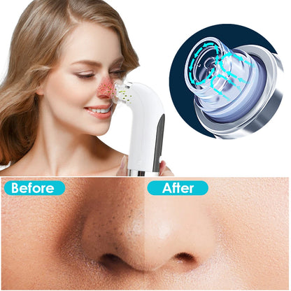 Dispozitiv Facial 7 în 1 EMS cu Terapie LED și Aspirator Comedon